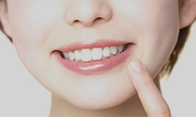 ホワイトニング